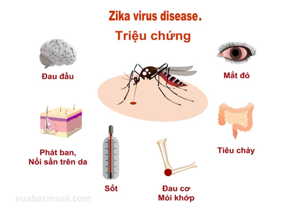 Các triệu chứng của bệnh Virus Zika