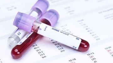 Cách đọc chỉ số xét nghiệm máu sốt xuất huyết