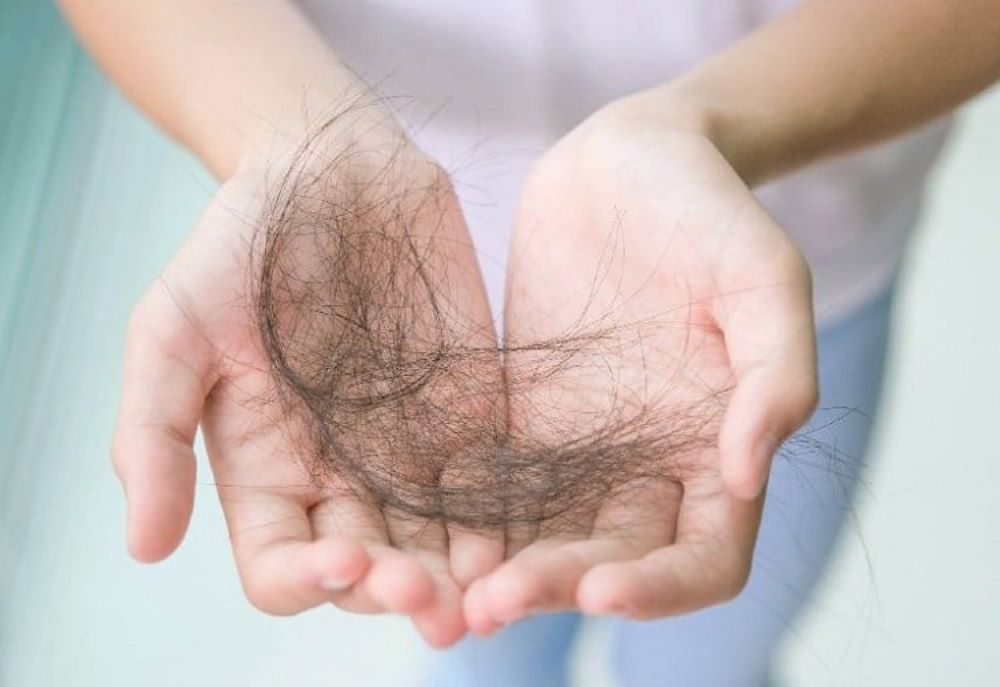 Nguyên nhân dẫn đến việc bị rụng tóc nhiều khi bị sốt xuất huyết